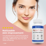 Zen Nutrients SkinVite Hormonal Breakouts & Clear Skin Support 60 Capsules